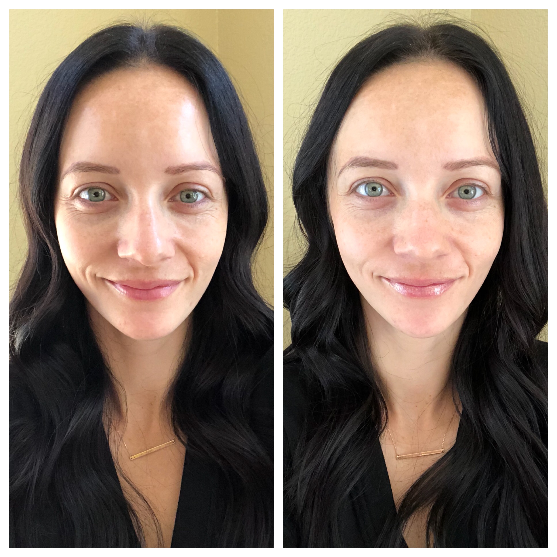 glytone chemical peel before and after featured by popular Las Vegas beauty blogger, Outfits & Outings
