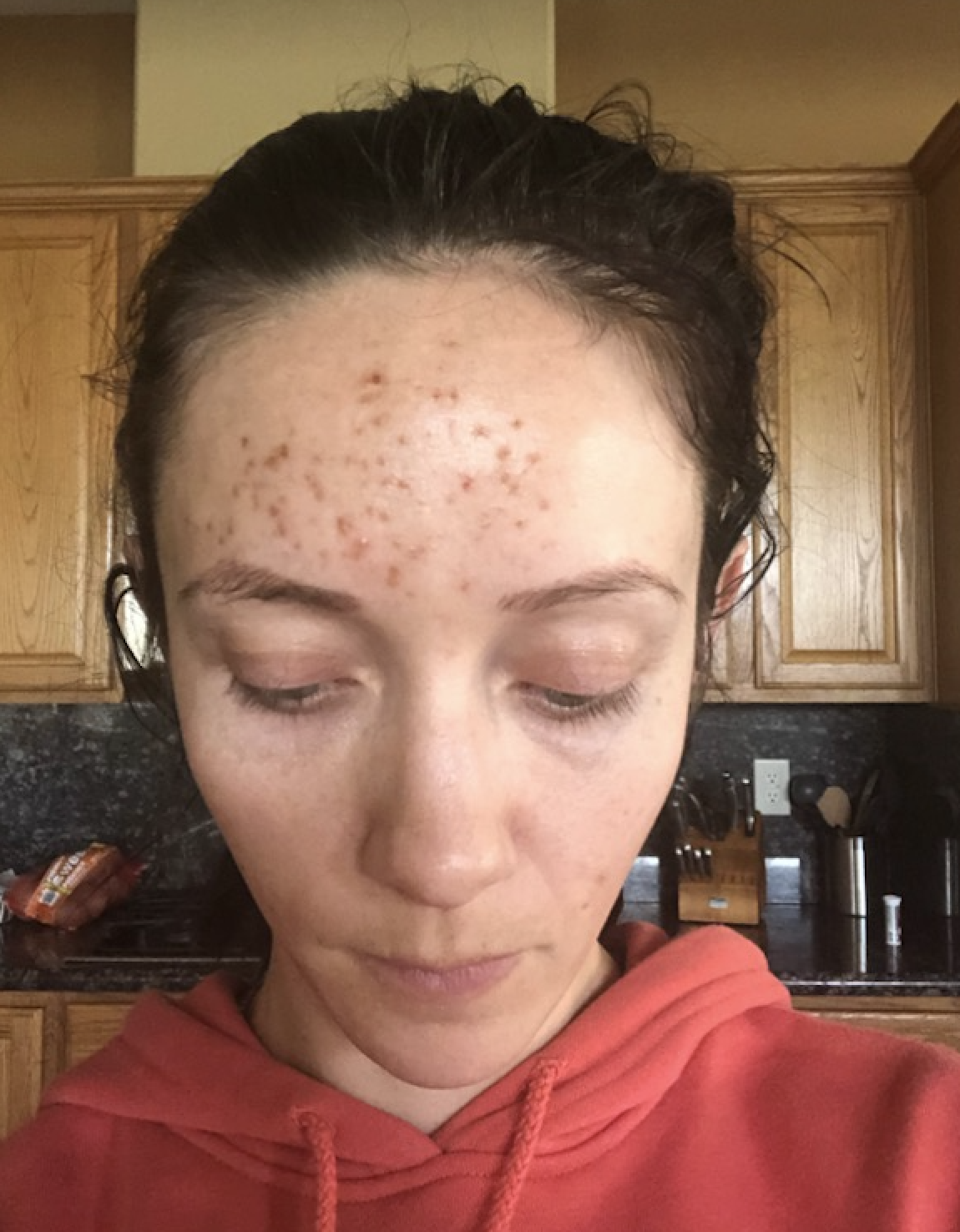 My Dior Forever Foundation Allergic Reaction & How to heal your skin featured by top US beauty blog, Outfits and Outings