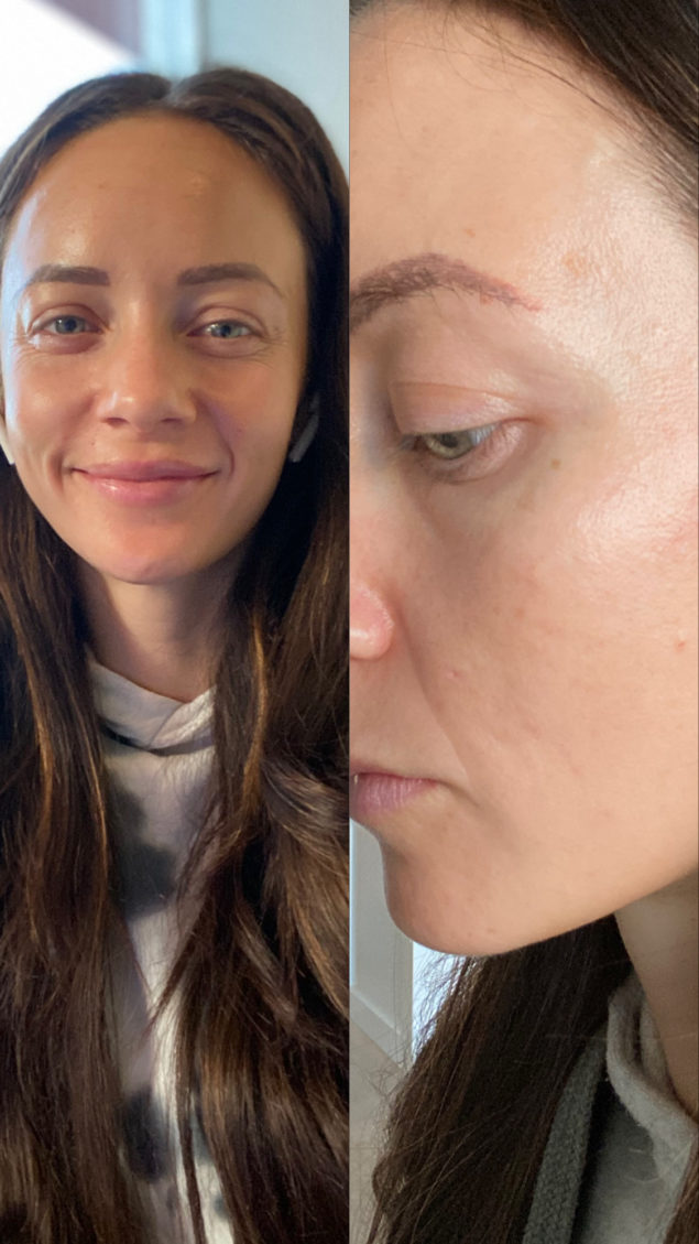 Acne and Anti Aging Skincare Routine by popular Las Vegas beauty blog, Outfits and Outings: collage image of a woman with clear skin. 